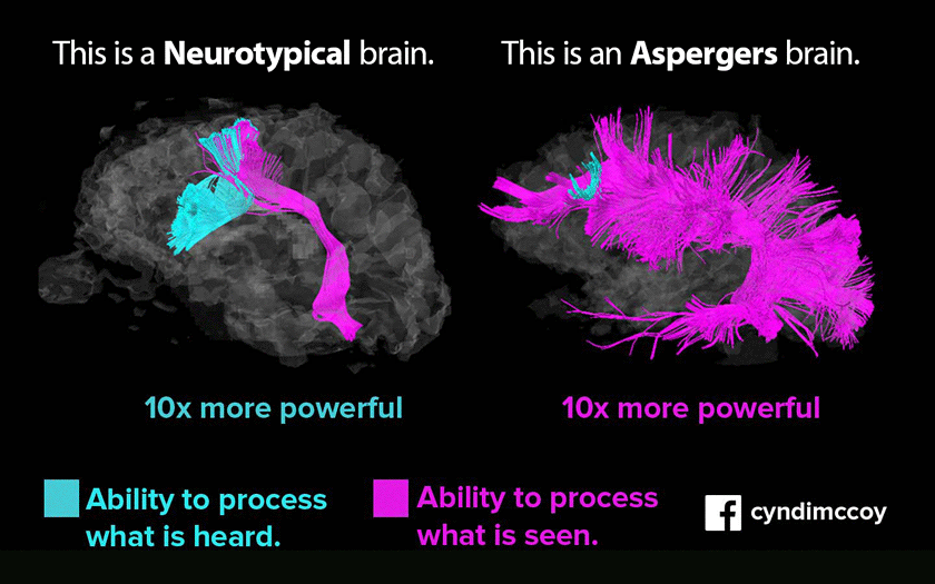 comparative-brain-activity